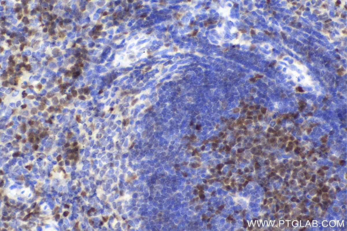 Immunohistochemical analysis of paraffin-embedded mouse spleen tissue slide using KHC2214 (DCK IHC Kit).