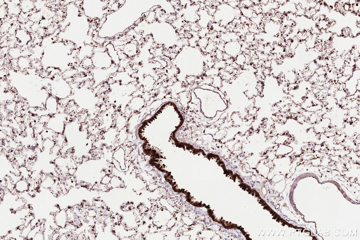 Immunohistochemical analysis of paraffin-embedded rat lung tissue slide using KHC2523 (DDR2 IHC Kit).