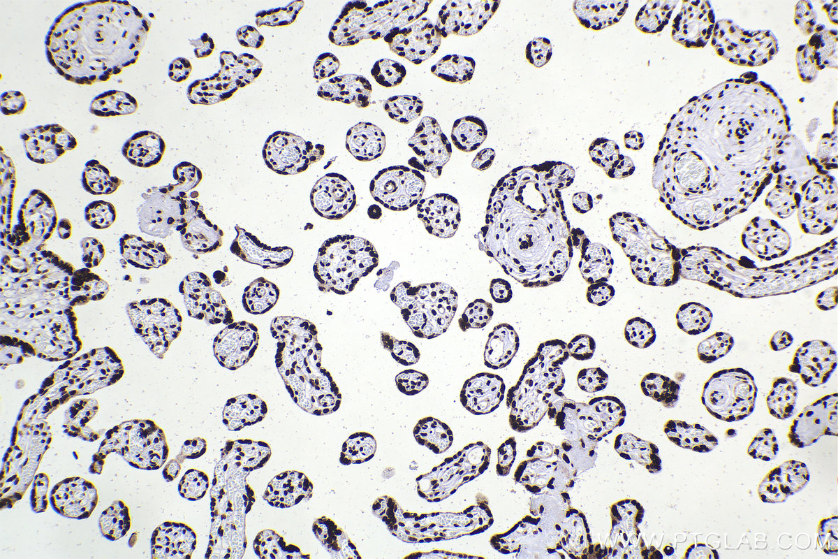 Immunohistochemical analysis of paraffin-embedded human placenta tissue slide using KHC2248 (DEK IHC Kit).