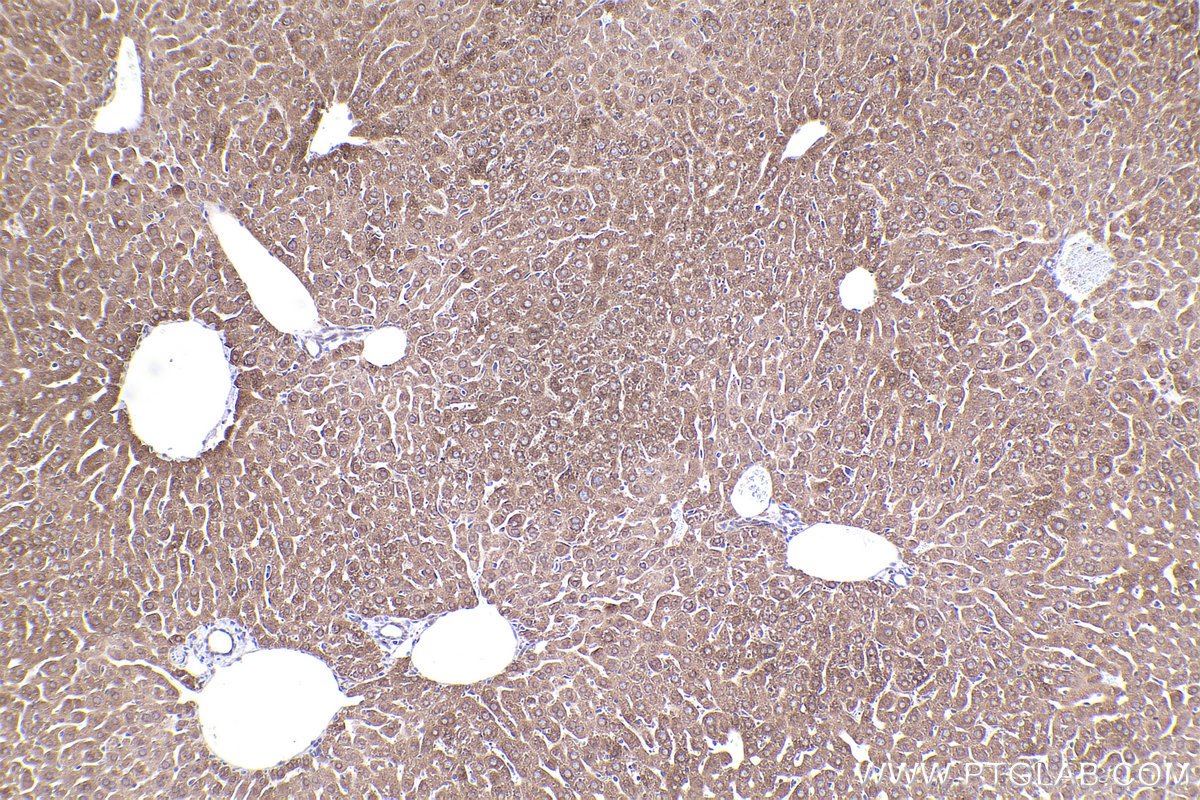 Immunohistochemical analysis of paraffin-embedded mouse liver tissue slide using KHC2488 (DHCR24 IHC Kit).