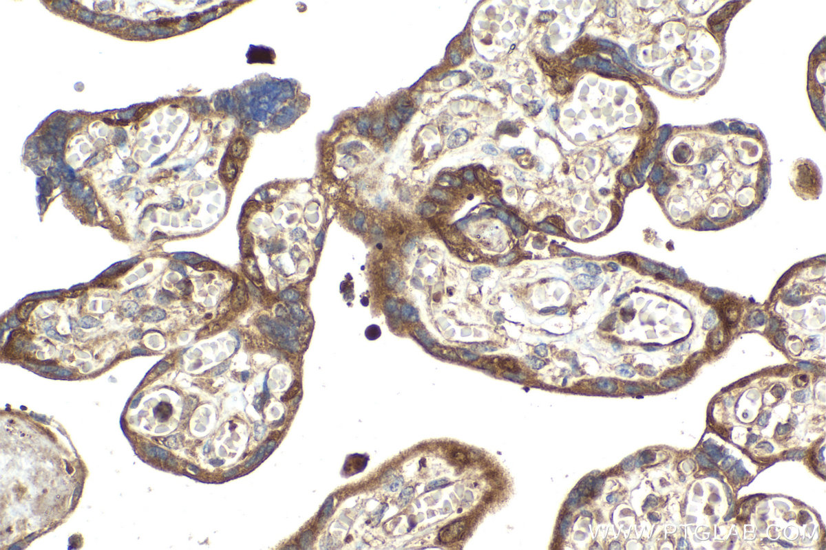 Immunohistochemical analysis of paraffin-embedded human placenta tissue slide using KHC2100 (DIAPH1 IHC Kit).