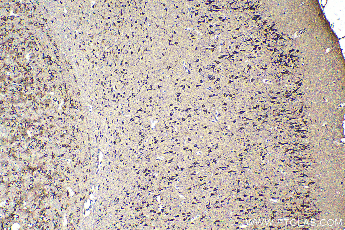 Immunohistochemical analysis of paraffin-embedded mouse brain tissue slide using KHC2100 (DIAPH1 IHC Kit).