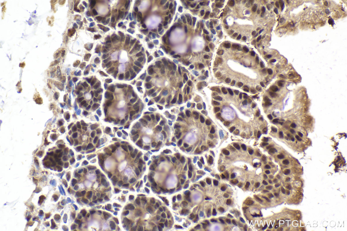 Immunohistochemical analysis of paraffin-embedded mouse small intestine tissue slide using KHC2015 (DIS3 IHC Kit).