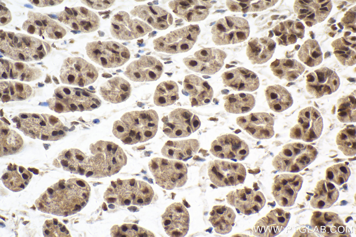 Immunohistochemical analysis of paraffin-embedded mouse stomach tissue slide using KHC2015 (DIS3 IHC Kit).