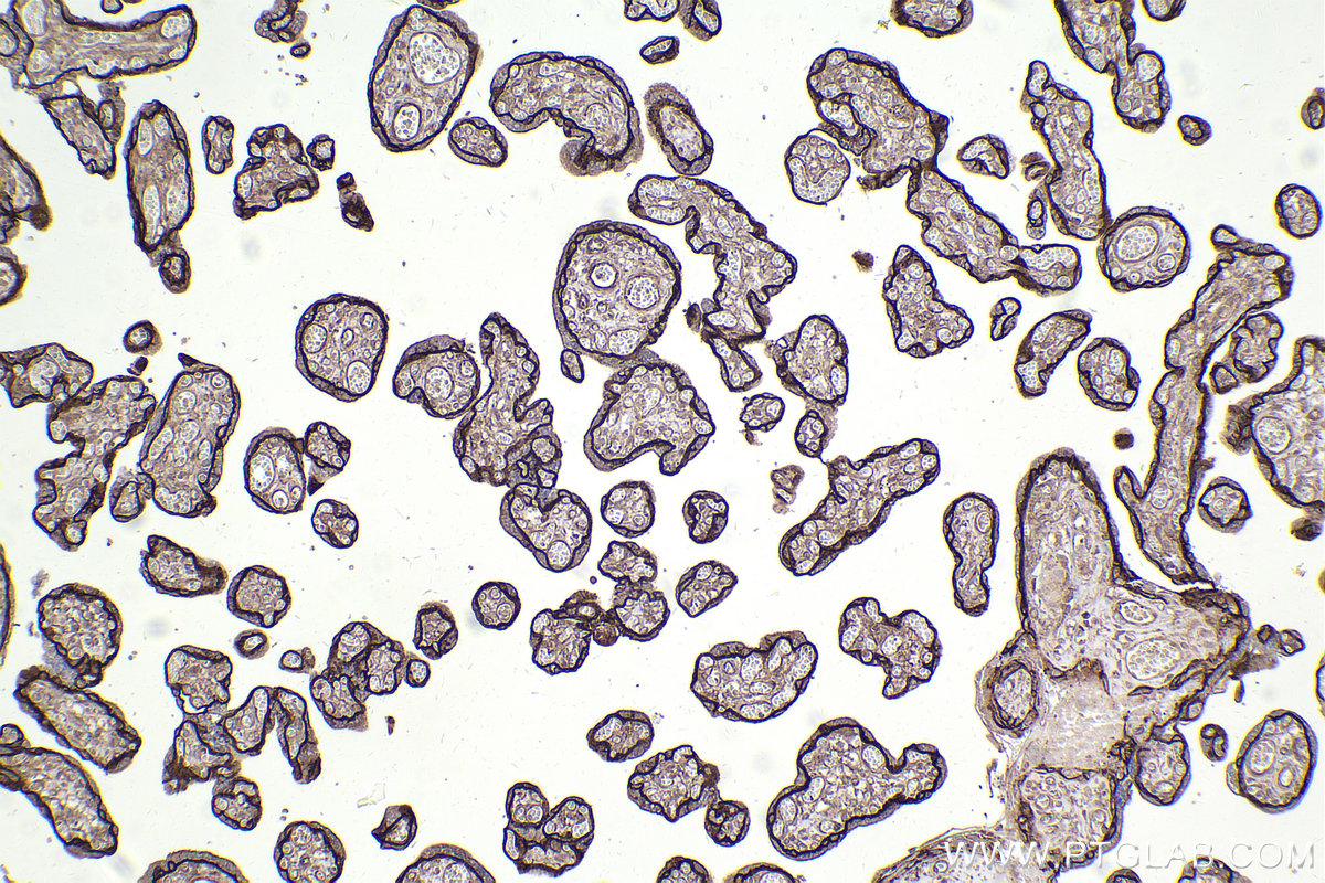 Immunohistochemical analysis of paraffin-embedded human placenta tissue slide using KHC2412 (DLG1 IHC Kit).