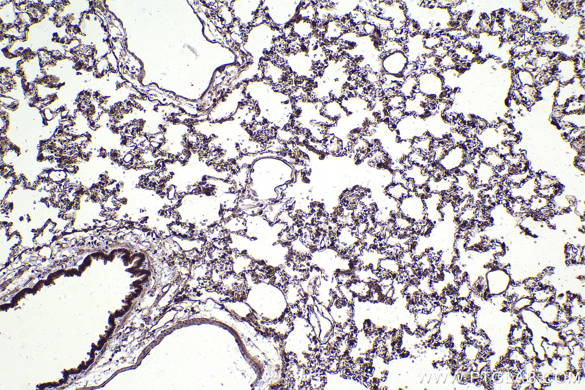 Immunohistochemical analysis of paraffin-embedded rat lung tissue slide using KHC2412 (DLG1 IHC Kit).