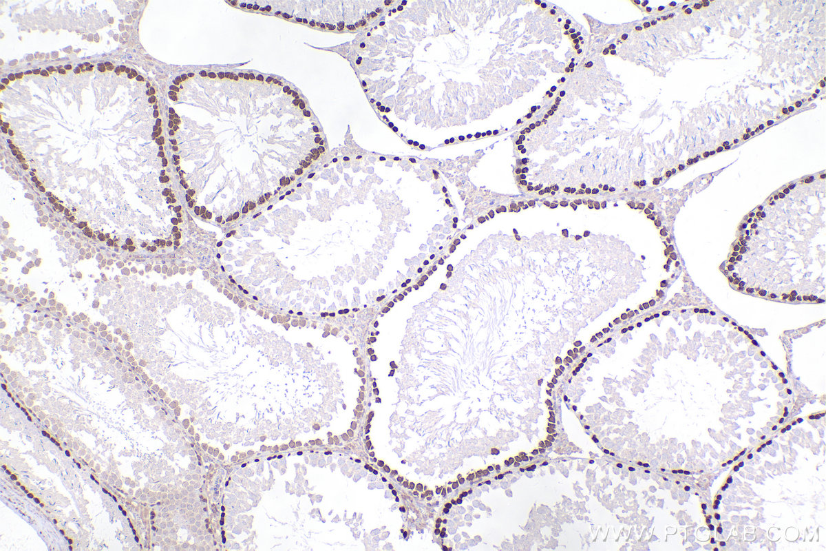 Immunohistochemical analysis of paraffin-embedded rat testis tissue slide using KHC2514 (DMC1 IHC Kit).