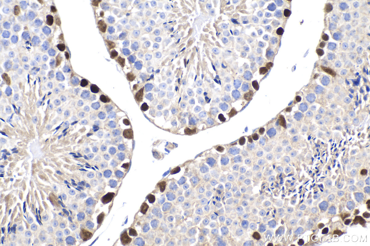 Immunohistochemical analysis of paraffin-embedded mouse testis tissue slide using KHC2027 (DMRT1 IHC Kit).