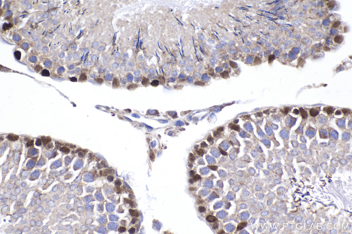 Immunohistochemical analysis of paraffin-embedded rat testis tissue slide using KHC2027 (DMRT1 IHC Kit).