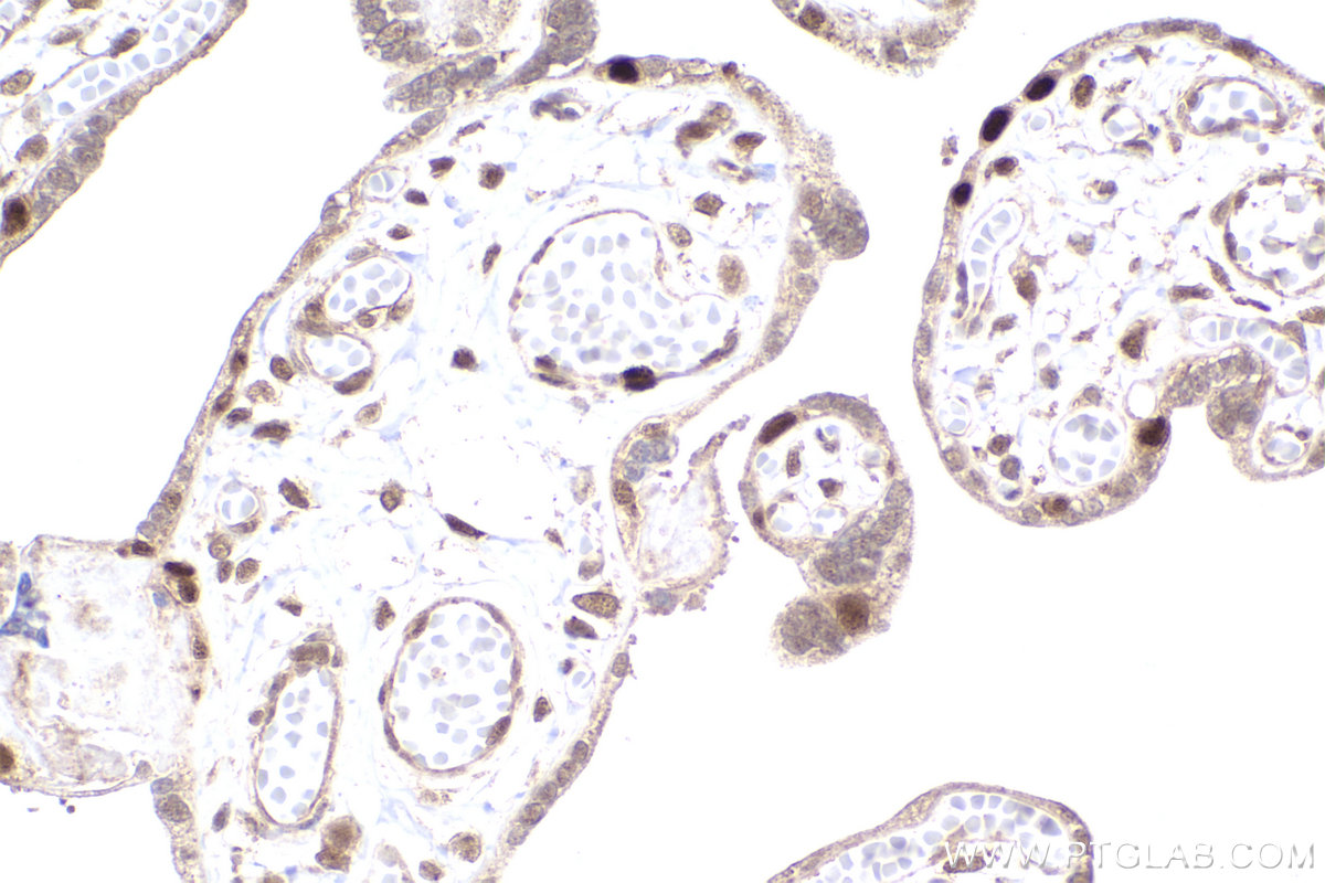 Immunohistochemical analysis of paraffin-embedded human placenta tissue slide using KHC2199 (LIG1 IHC Kit).