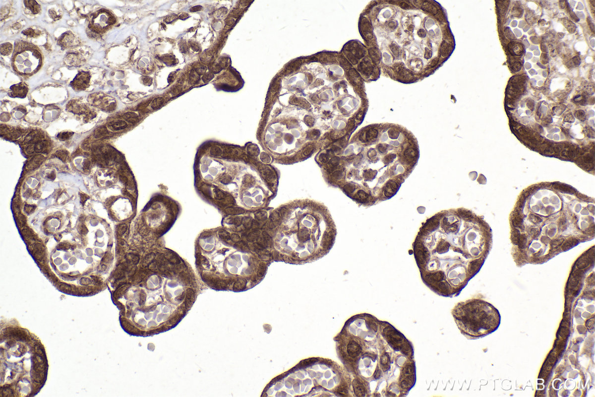 Immunohistochemical analysis of paraffin-embedded human placenta tissue slide using KHC2234 (DNAJA1 IHC Kit).