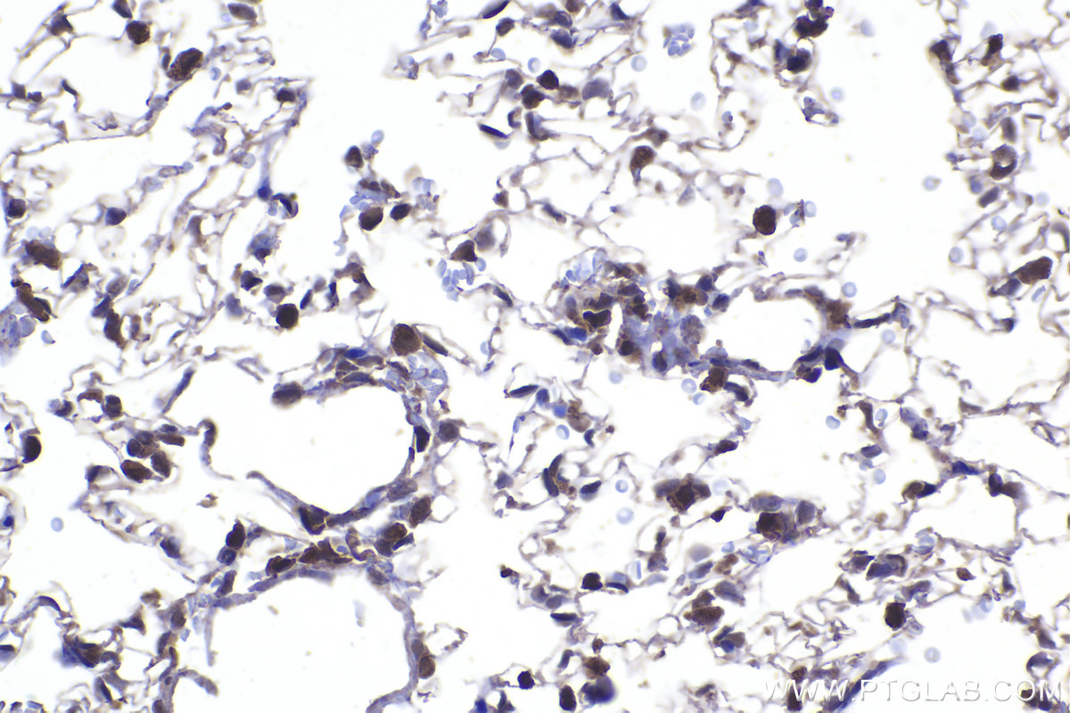 Immunohistochemical analysis of paraffin-embedded rat lung tissue slide using KHC2234 (DNAJA1 IHC Kit).