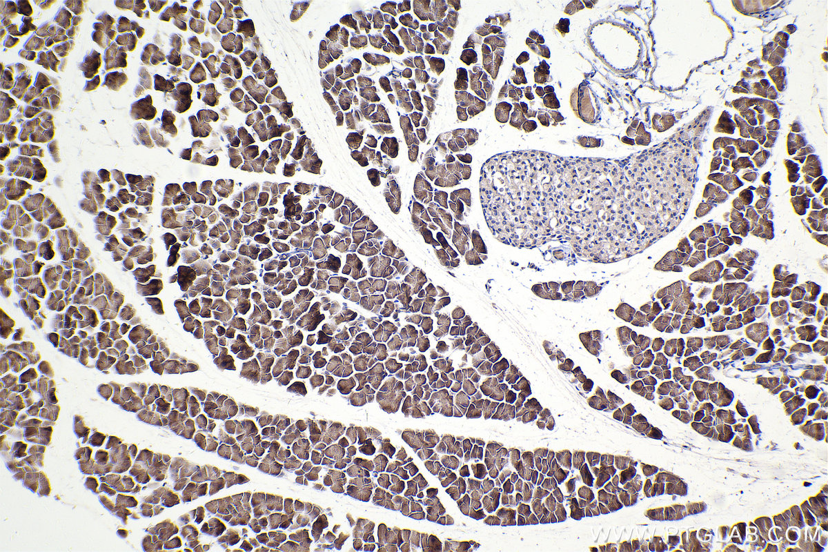 Immunohistochemical analysis of paraffin-embedded mouse pancreas tissue slide using KHC2454 (DOCK1 IHC Kit).