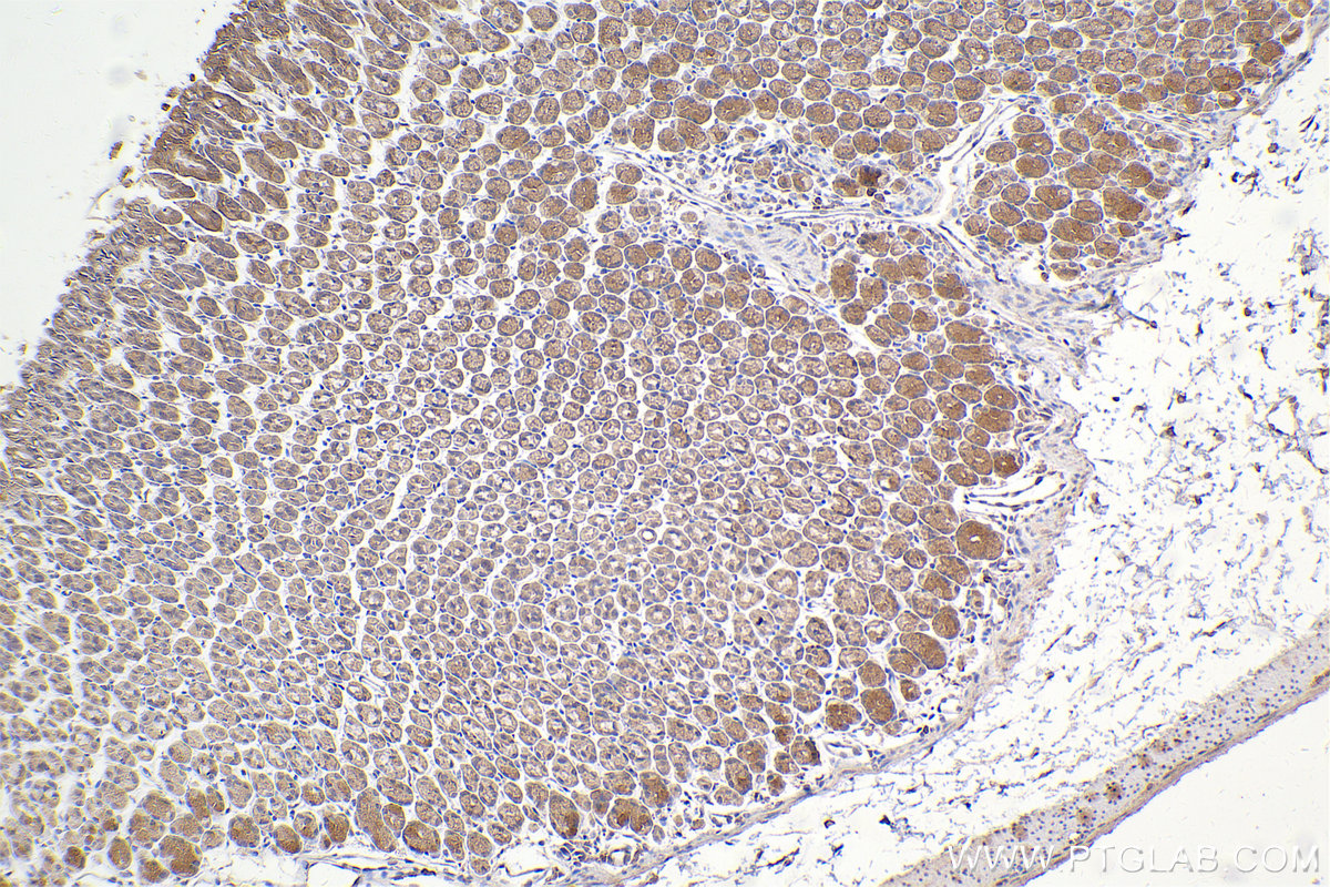 Immunohistochemical analysis of paraffin-embedded mouse stomach tissue slide using KHC2454 (DOCK1 IHC Kit).