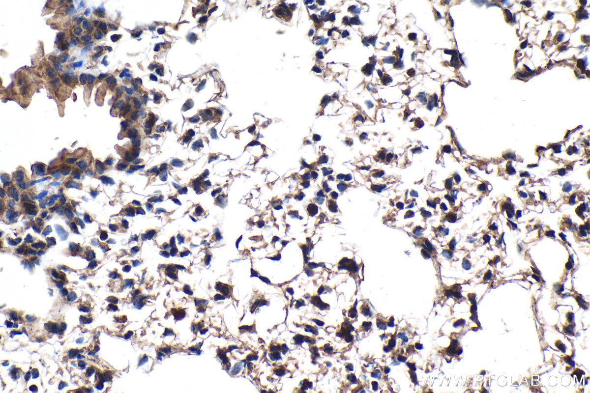 Immunohistochemical analysis of paraffin-embedded mouse lung tissue slide using KHC2103 (DPM1 IHC Kit).