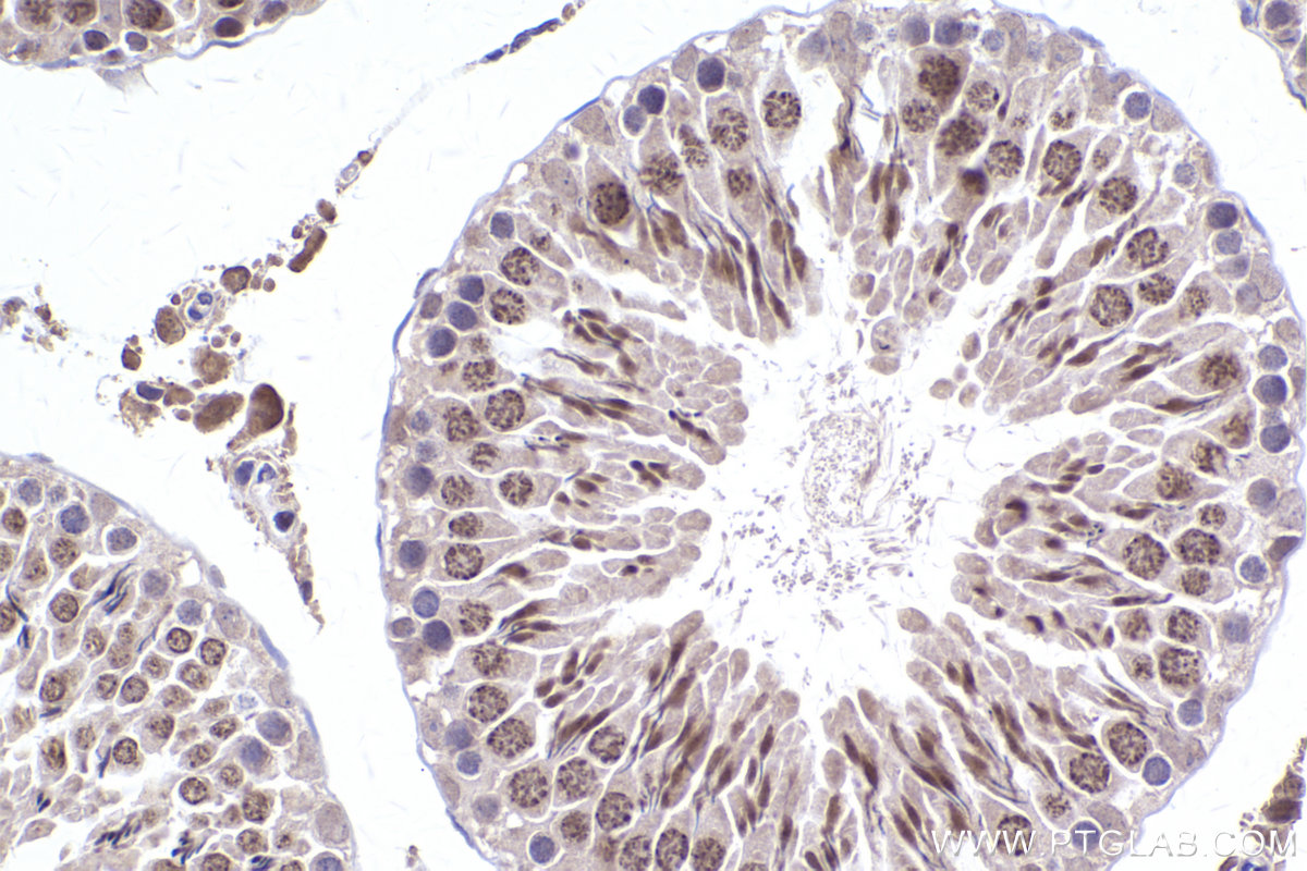 Immunohistochemical analysis of paraffin-embedded rat testis tissue slide using KHC2394 (DUSP2 IHC Kit).