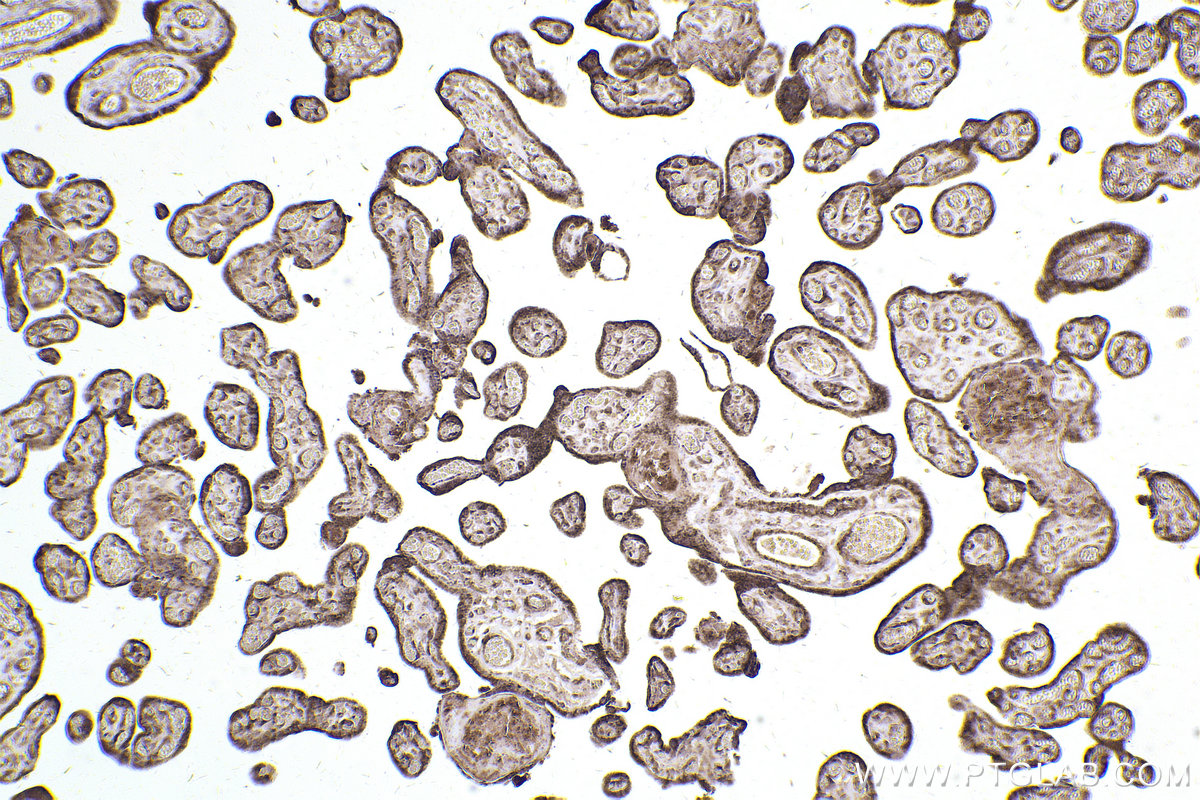 Immunohistochemical analysis of paraffin-embedded human placenta tissue slide using KHC2521 (DUSP6 IHC Kit).