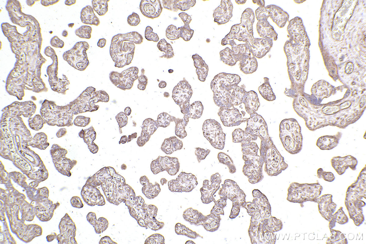 Immunohistochemical analysis of paraffin-embedded human placenta tissue slide using KHC2522 (DUSP7 IHC Kit).