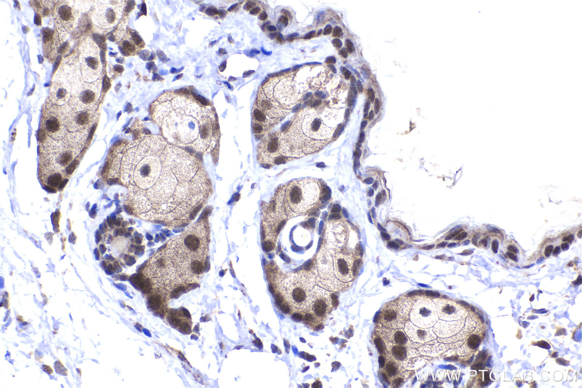 Immunohistochemical analysis of paraffin-embedded mouse skin tissue slide using KHC2239 (DUT IHC Kit).