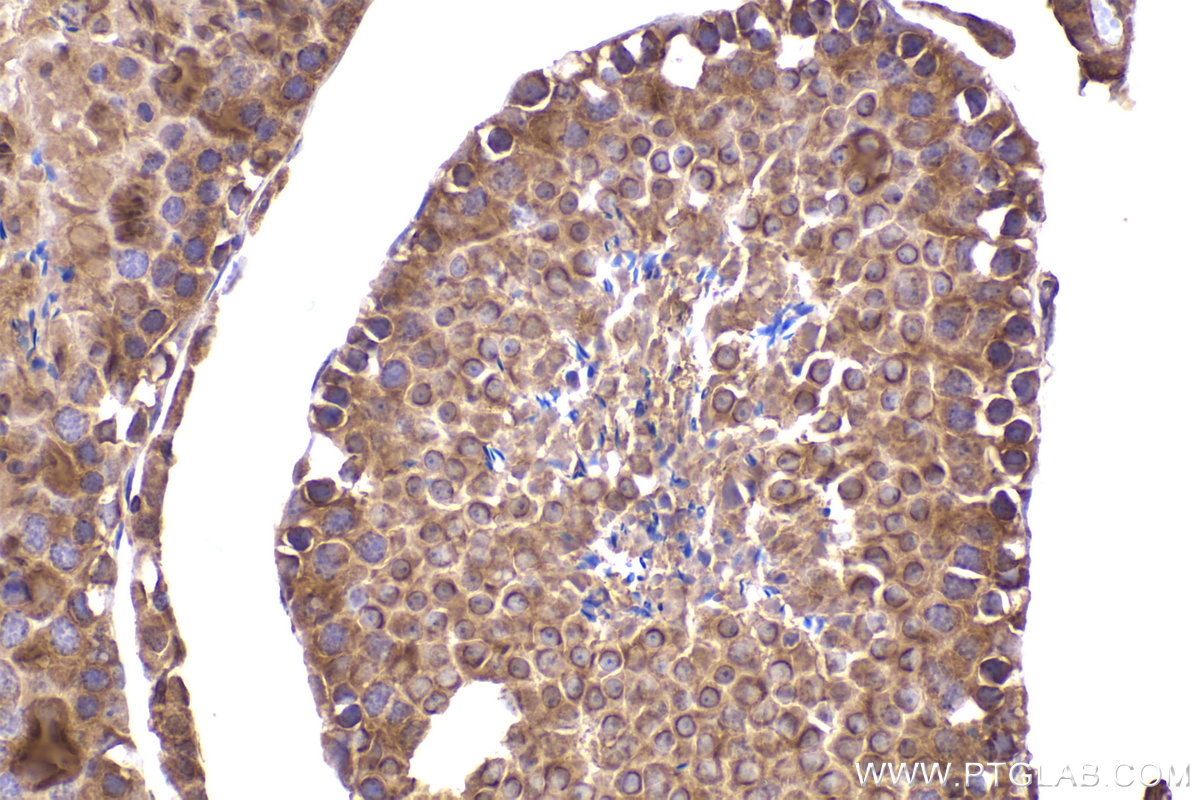 Immunohistochemical analysis of paraffin-embedded mouse testis tissue slide using KHC2455 (DYNC1H1 IHC Kit).