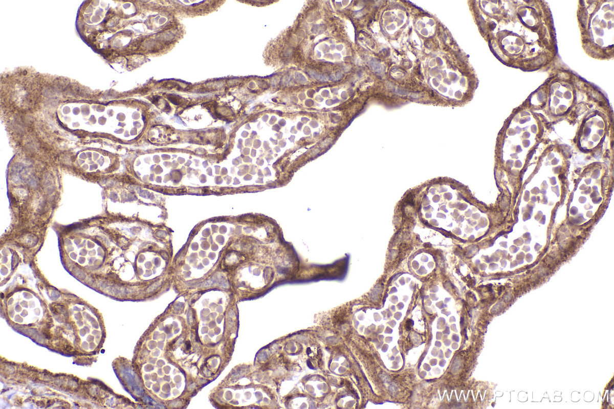 Immunohistochemical analysis of paraffin-embedded human placenta tissue slide using KHC2455 (DYNC1H1 IHC Kit).