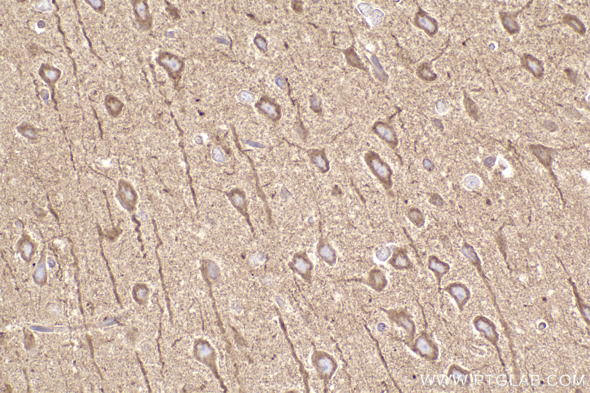 Immunohistochemical analysis of paraffin-embedded rat brain tissue slide using KHC2455 (DYNC1H1 IHC Kit).