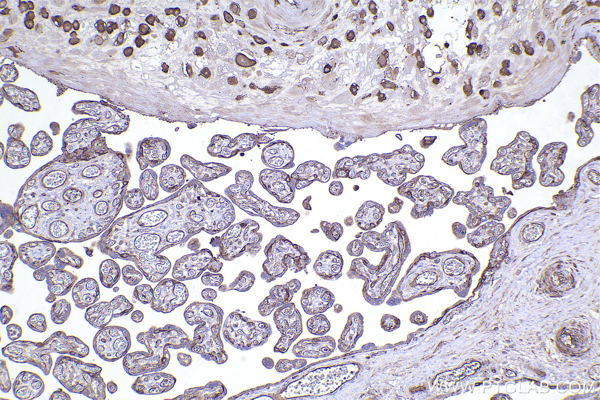 Immunohistochemical analysis of paraffin-embedded human placenta tissue slide using KHC2359 (DYNLT1 IHC Kit).