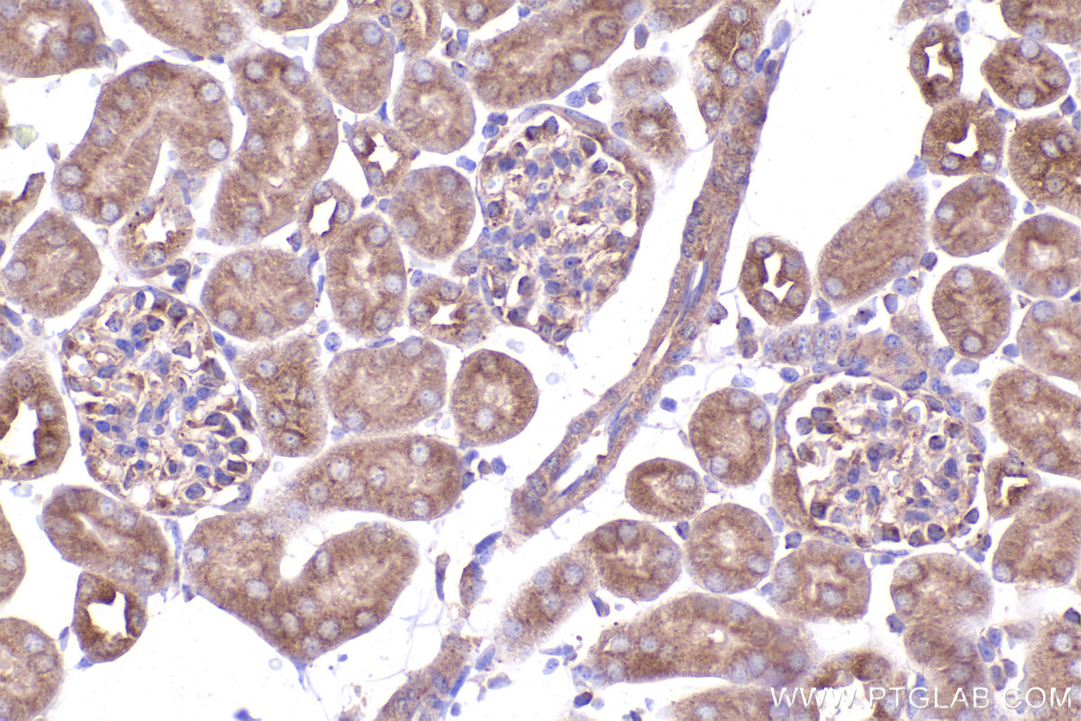 Immunohistochemical analysis of paraffin-embedded mouse kidney tissue slide using KHC2359 (DYNLT1 IHC Kit).