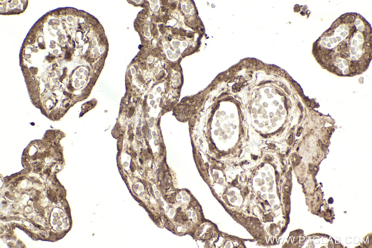 Immunohistochemical analysis of paraffin-embedded human placenta tissue slide using KHC2306 (DYNLT3 IHC Kit).