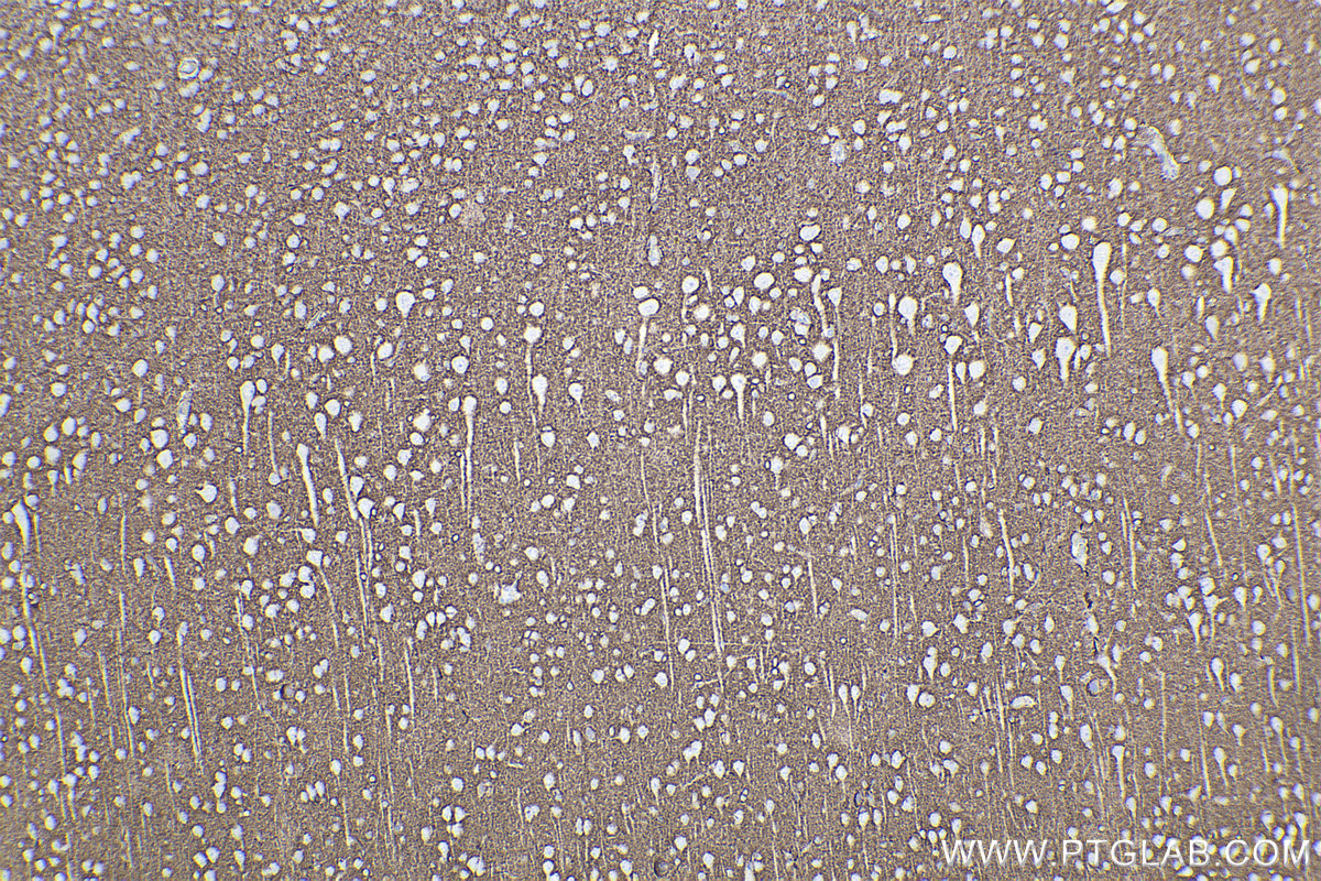 Immunohistochemical analysis of paraffin-embedded rat brain tissue slide using KHC2269 (EAAT2/SLC1A2 IHC Kit).