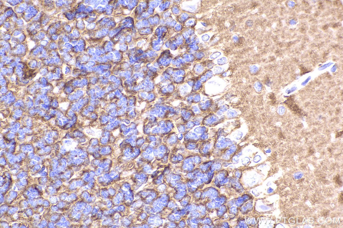 Immunohistochemical analysis of paraffin-embedded rat cerebellum tissue slide using KHC2269 (EAAT2/SLC1A2 IHC Kit).