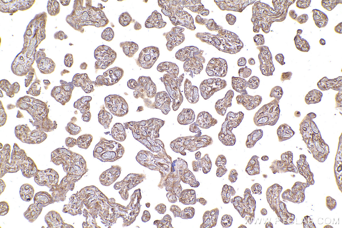 Immunohistochemical analysis of paraffin-embedded human placenta tissue slide using KHC2418 (EIF2B5 IHC Kit).