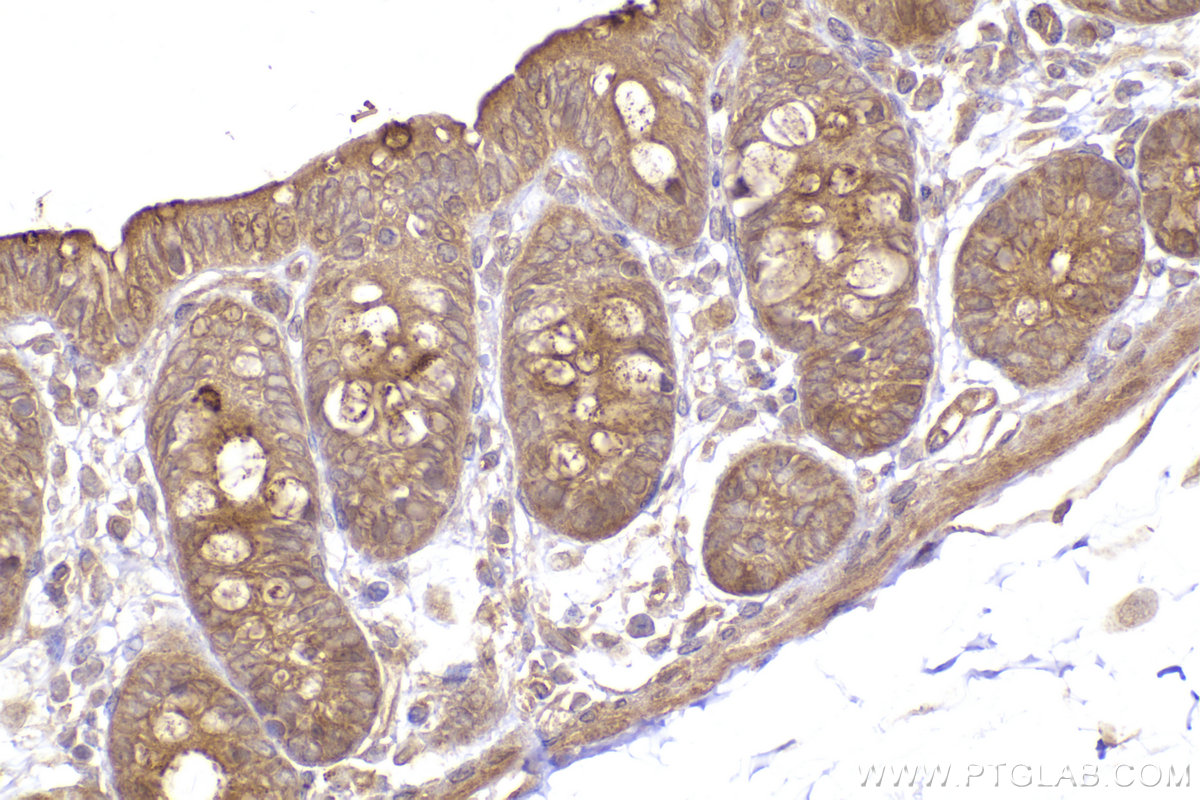 Immunohistochemical analysis of paraffin-embedded rat colon tissue slide using KHC2418 (EIF2B5 IHC Kit).