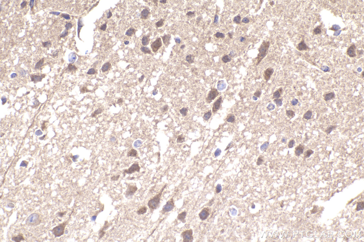 Immunohistochemical analysis of paraffin-embedded mouse brain tissue slide using KHC2327 (EIF5 IHC Kit).