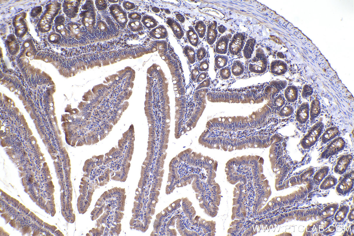 Immunohistochemical analysis of paraffin-embedded rat small intestine tissue slide using KHC2327 (EIF5 IHC Kit).