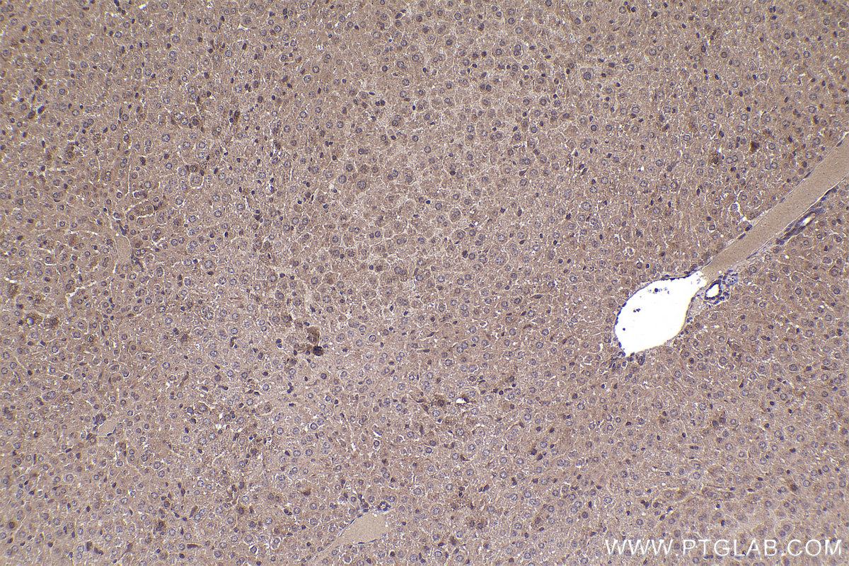 Immunohistochemical analysis of paraffin-embedded mouse liver tissue slide using KHC2326 (EPHB4 IHC Kit).