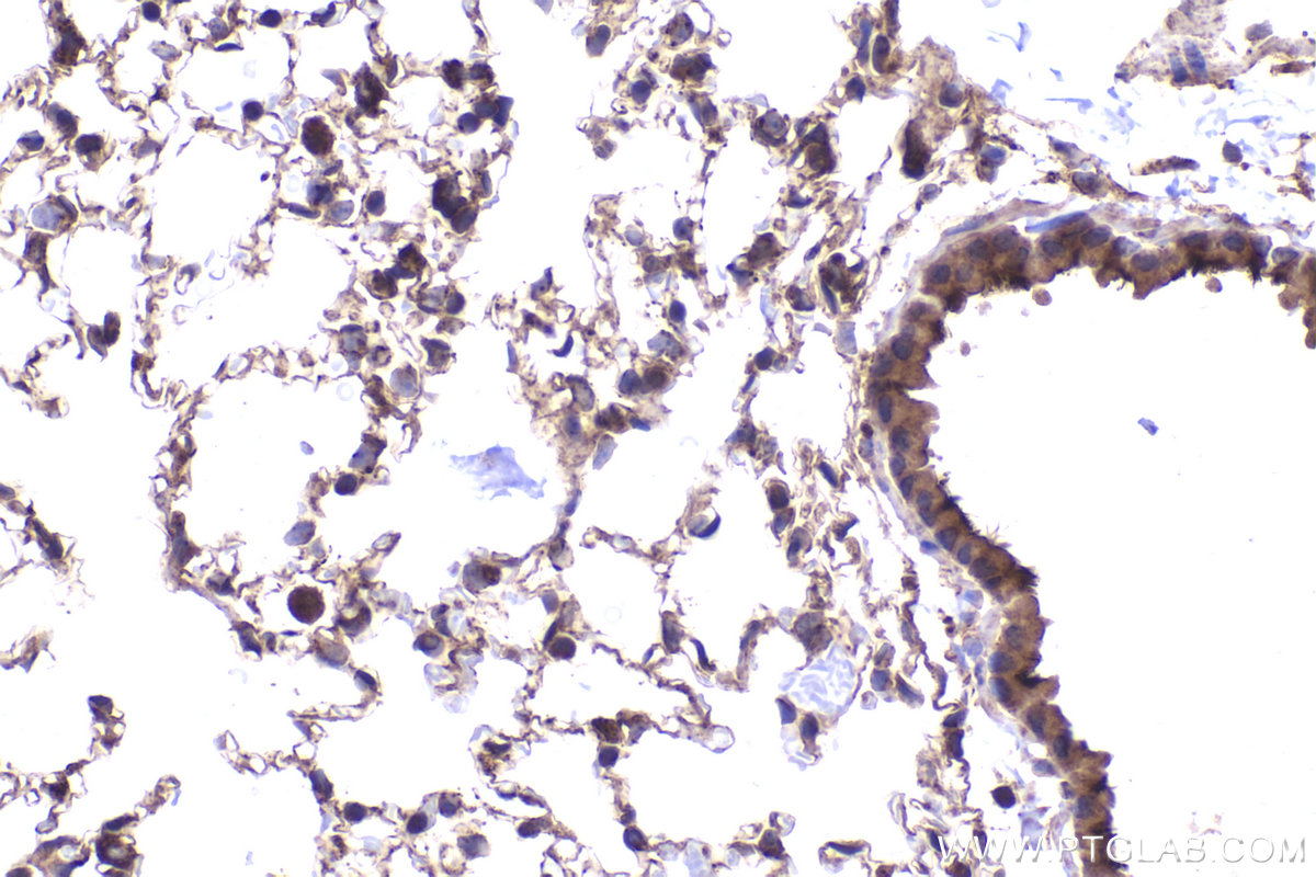 Immunohistochemical analysis of paraffin-embedded mouse lung tissue slide using KHC2326 (EPHB4 IHC Kit).