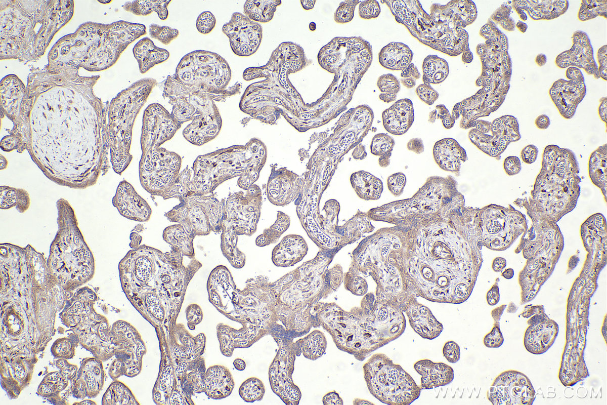 Immunohistochemical analysis of paraffin-embedded human placenta tissue slide using KHC2411 (EPS8 IHC Kit).