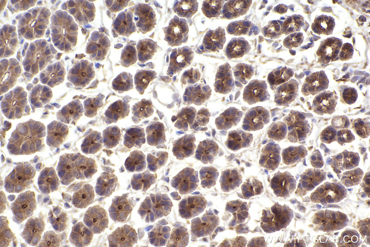 Immunohistochemical analysis of paraffin-embedded mouse stomach tissue slide using KHC2411 (EPS8 IHC Kit).