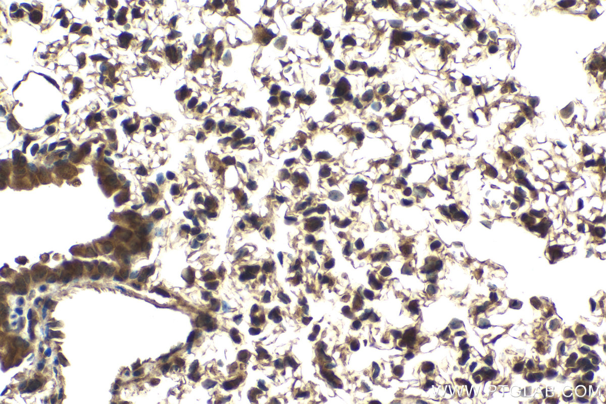 Immunohistochemical analysis of paraffin-embedded mouse lung tissue slide using KHC2117 (ERAL1 IHC Kit).