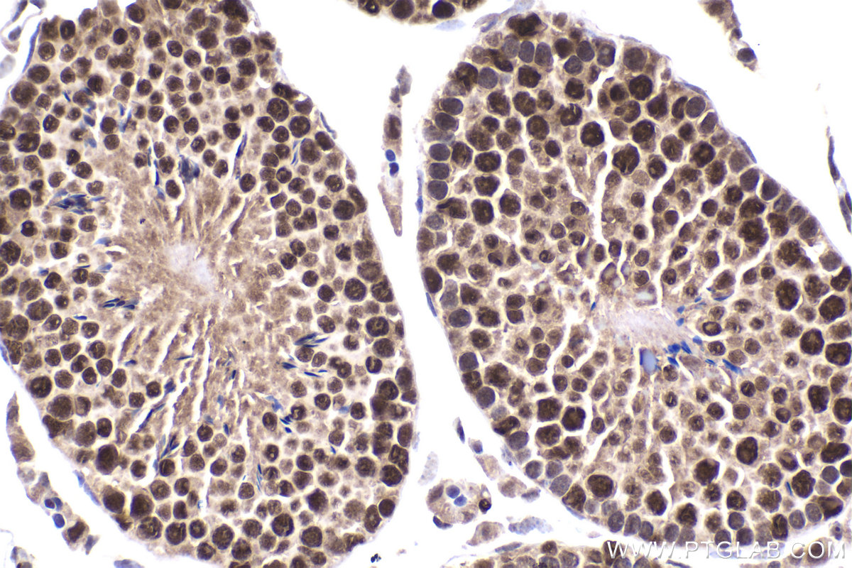 Immunohistochemical analysis of paraffin-embedded mouse testis tissue slide using KHC2197 (ERCC2 IHC Kit).