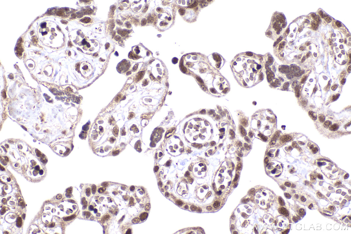 Immunohistochemical analysis of paraffin-embedded human placenta tissue slide using KHC2197 (ERCC2 IHC Kit).