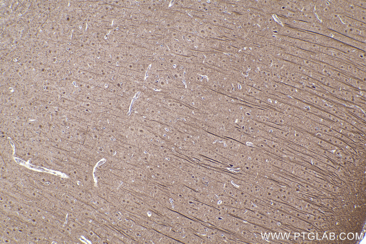 Immunohistochemical analysis of paraffin-embedded rat brain tissue slide using KHC2197 (ERCC2 IHC Kit).