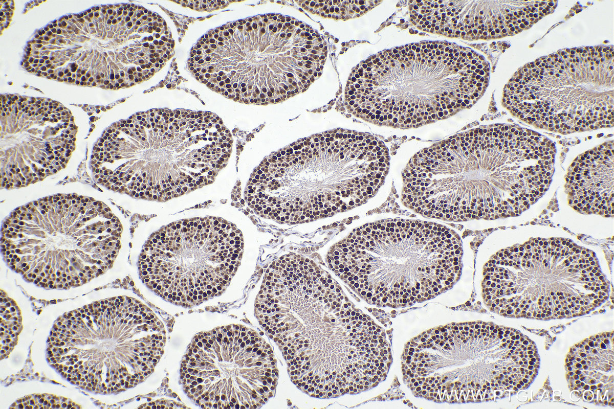 Immunohistochemical analysis of paraffin-embedded rat testis tissue slide using KHC2197 (ERCC2 IHC Kit).