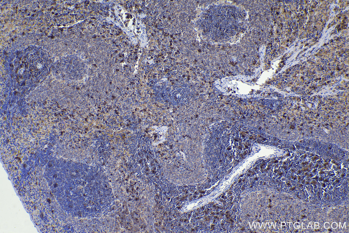 Immunohistochemical analysis of paraffin-embedded rat spleen tissue slide using KHC2242 (EVI2B IHC Kit).