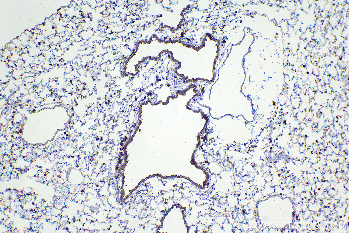 Immunohistochemical analysis of paraffin-embedded mouse lung tissue slide using KHC2242 (EVI2B IHC Kit).