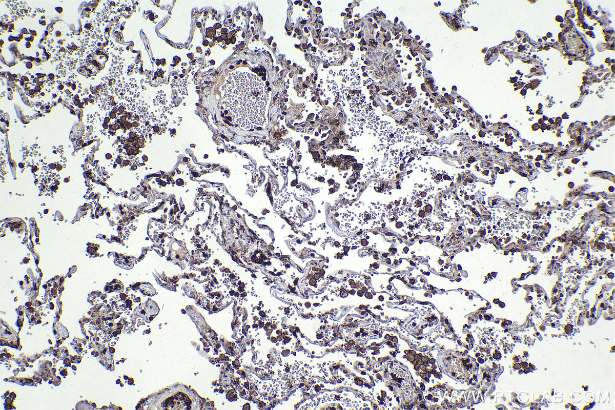 Immunohistochemical analysis of paraffin-embedded human lung tissue slide using KHC2242 (EVI2B IHC Kit).