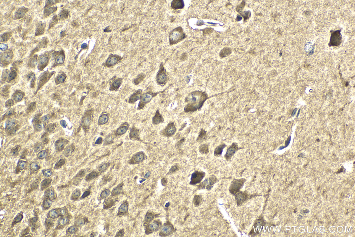 Immunohistochemical analysis of paraffin-embedded mouse brain tissue slide using KHC2046 (EXOC5 IHC Kit).
