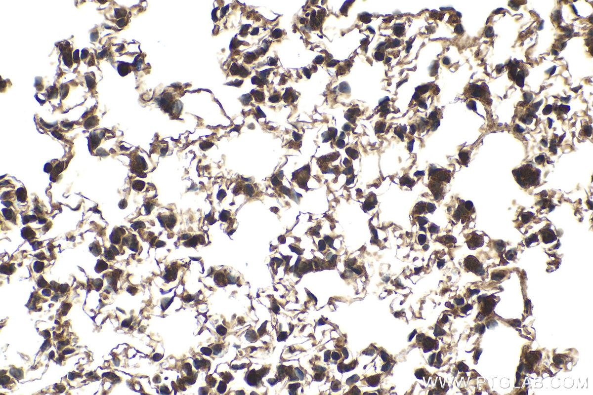 Immunohistochemical analysis of paraffin-embedded mouse lung tissue slide using KHC2046 (EXOC5 IHC Kit).