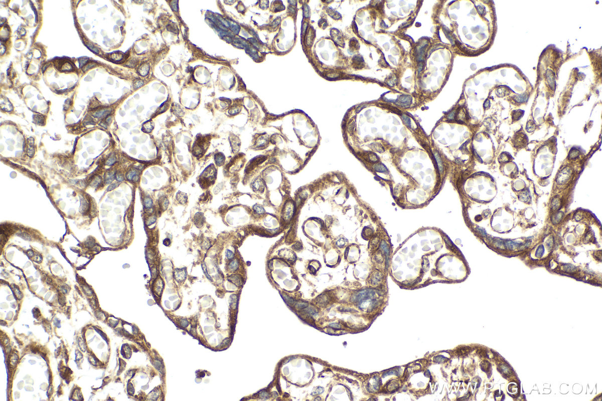 Immunohistochemical analysis of paraffin-embedded human placenta tissue slide using KHC2082 (FAM62B IHC Kit).